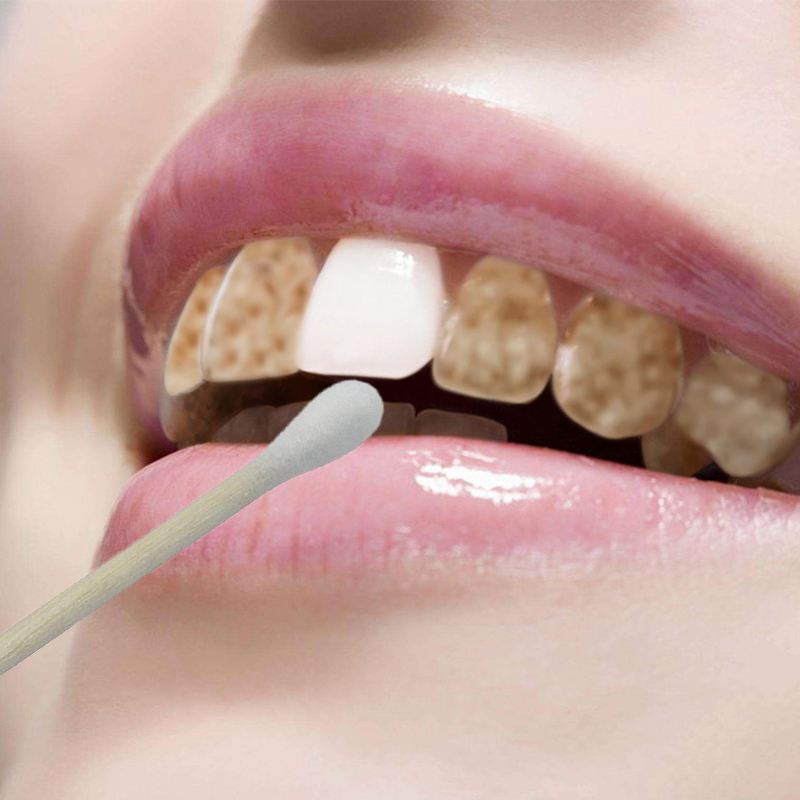 如何刷牙才能让牙不黄 809578d0f53440dba67044cd21313916.jpeg