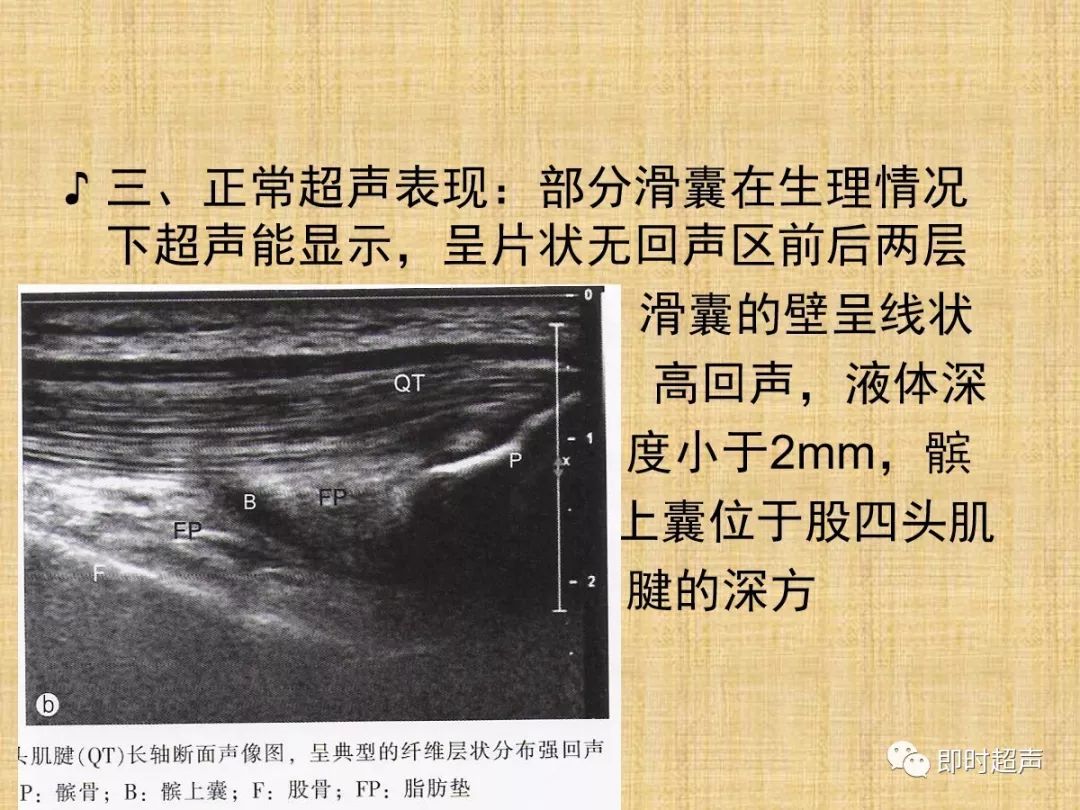 肌肉骨骼疾病的超声诊断