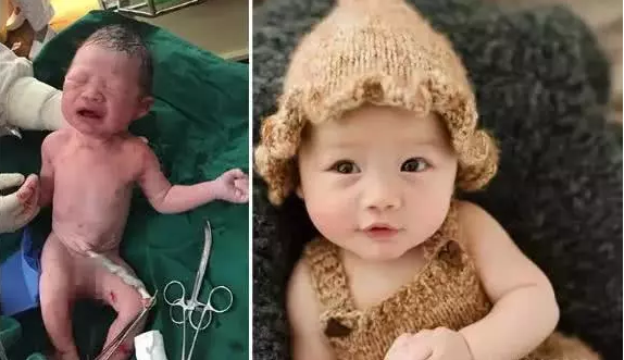                     原创            刚出生的婴儿“奇丑”是一种什么体验？看完之后竟然笑喷了……