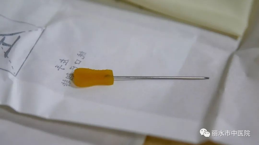【中医特色】小针刀 大作用