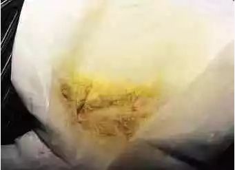                     大便出现这些东西就是消化不良？肯定有你家宝宝那一款