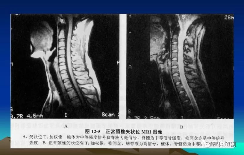 图解颈椎精细解剖颈椎病