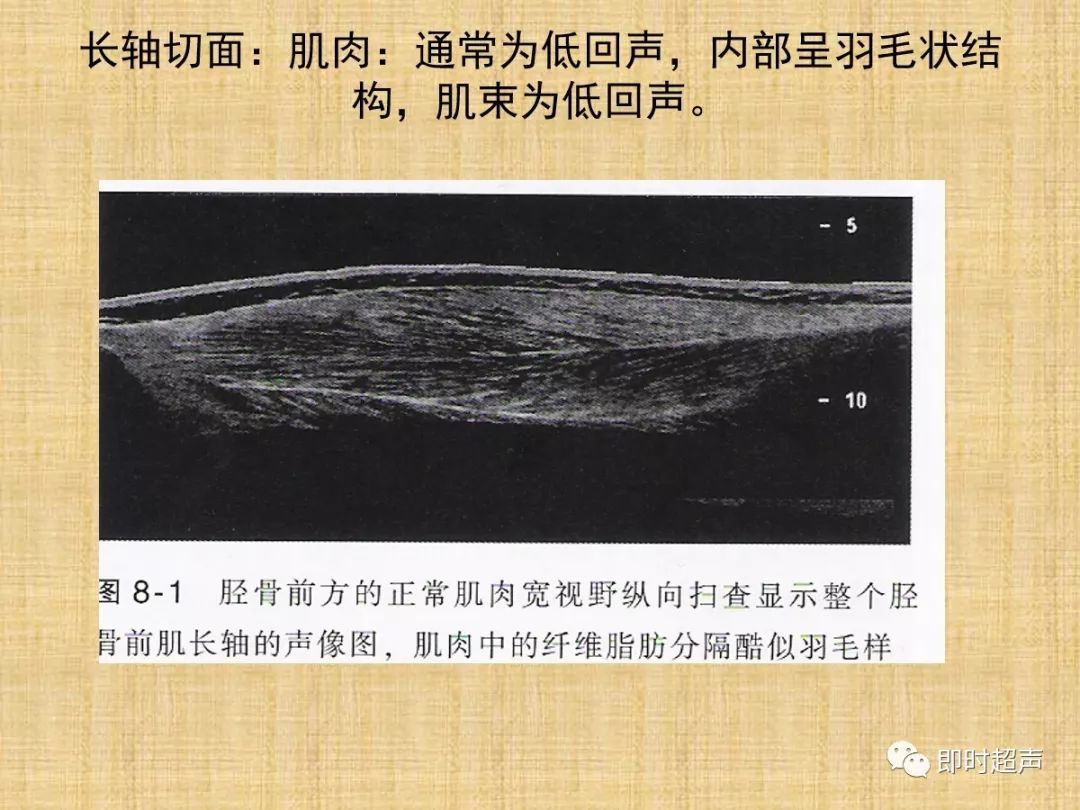 肌肉骨骼疾病的超声诊断