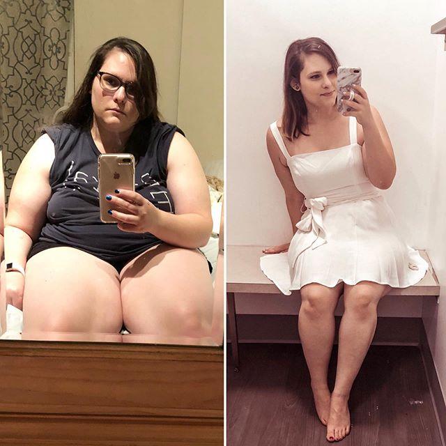 250斤女子不手术不吃药,两点改变助其减肥,再也不害怕