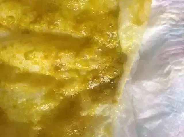                     大便出现这些东西就是消化不良？肯定有你家宝宝那一款