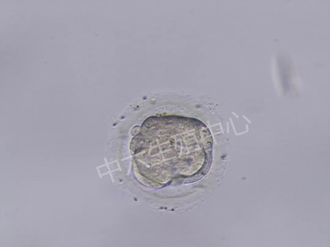 取卵后的第三天,如患者移植,胚胎通常长为6~9细胞,可进行移植,但有些