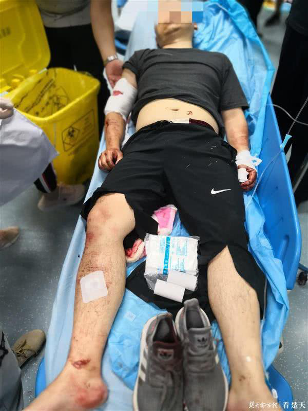 血染巷口!武汉民警被捅多刀仍牢牢抓住毒贩