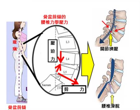 站久了腰疼怎么办