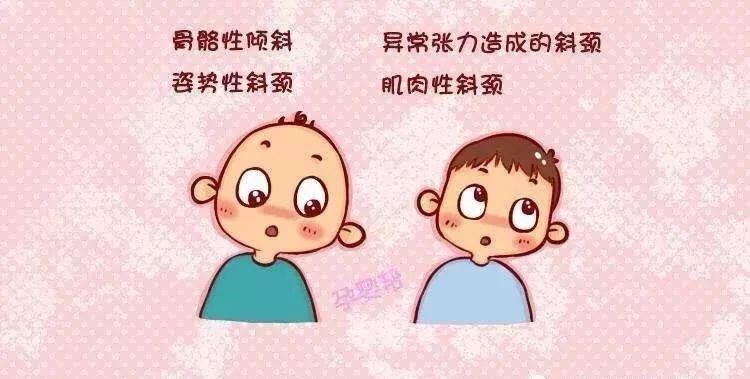 歪脖子也是病,小儿斜颈如何治?