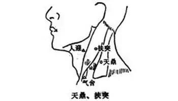 扶突穴:咳嗽 气踹 咽喉肿痛