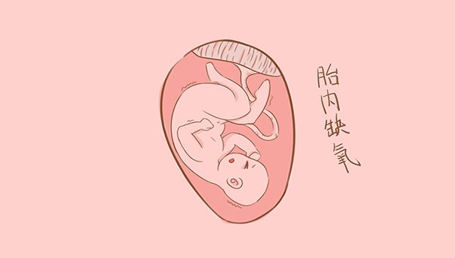                     原创            宝宝出生时不哭，医生要打到哭为止？知道原因才知是为了宝宝好
