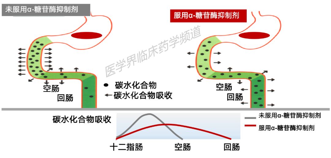 α-糖苷酶抑制剂抑制这一类酶从而延迟碳水化物吸收,降低餐后高血糖