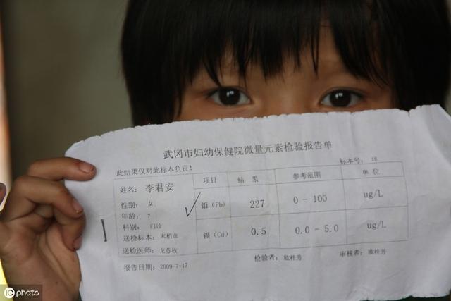                     原创            一家五口铅中毒！铅中毒损伤大脑，这5大危险，你孩子身边也有