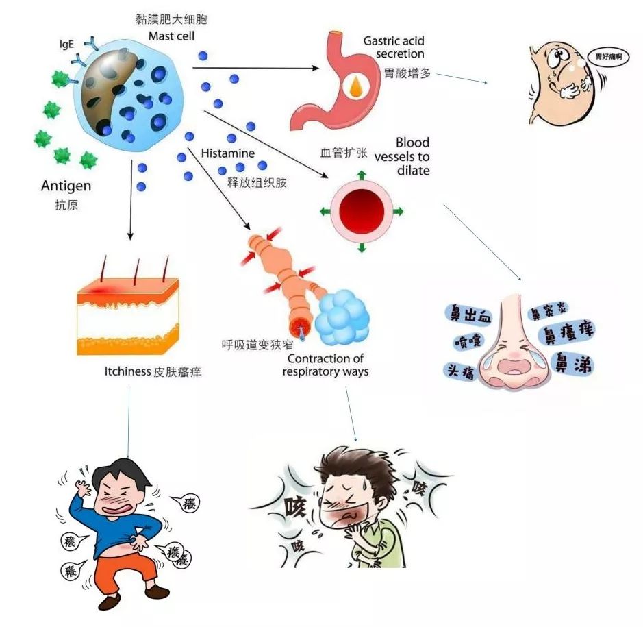 【药我说】对抗过敏有妙招,抗组胺药品来帮忙