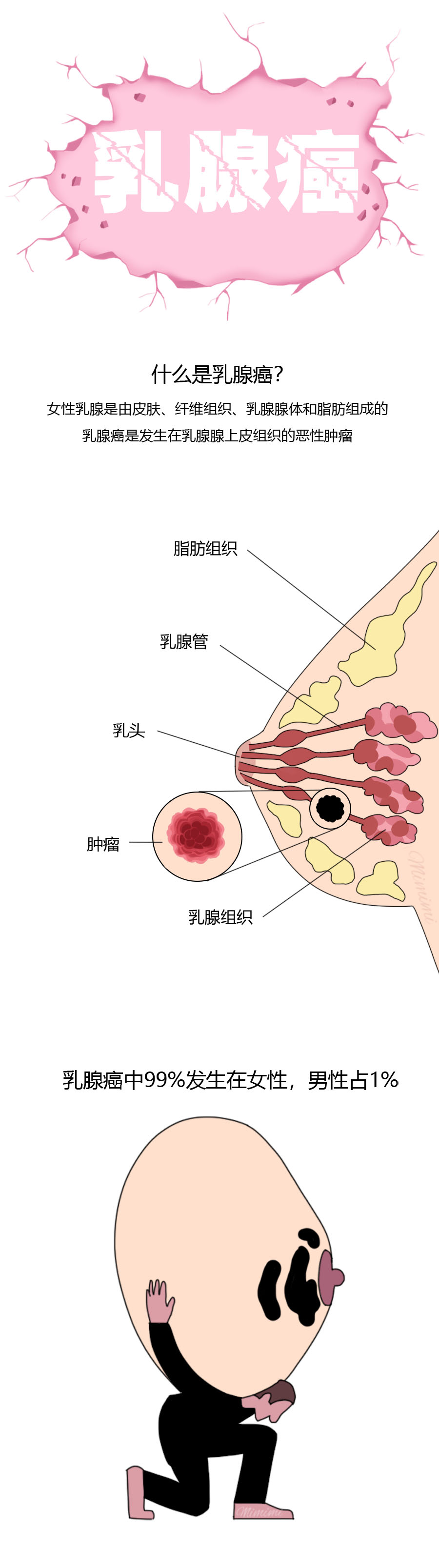 发现这些请看医生:乳房皮肤溃烂或增厚乳头或乳房凹陷乳房或