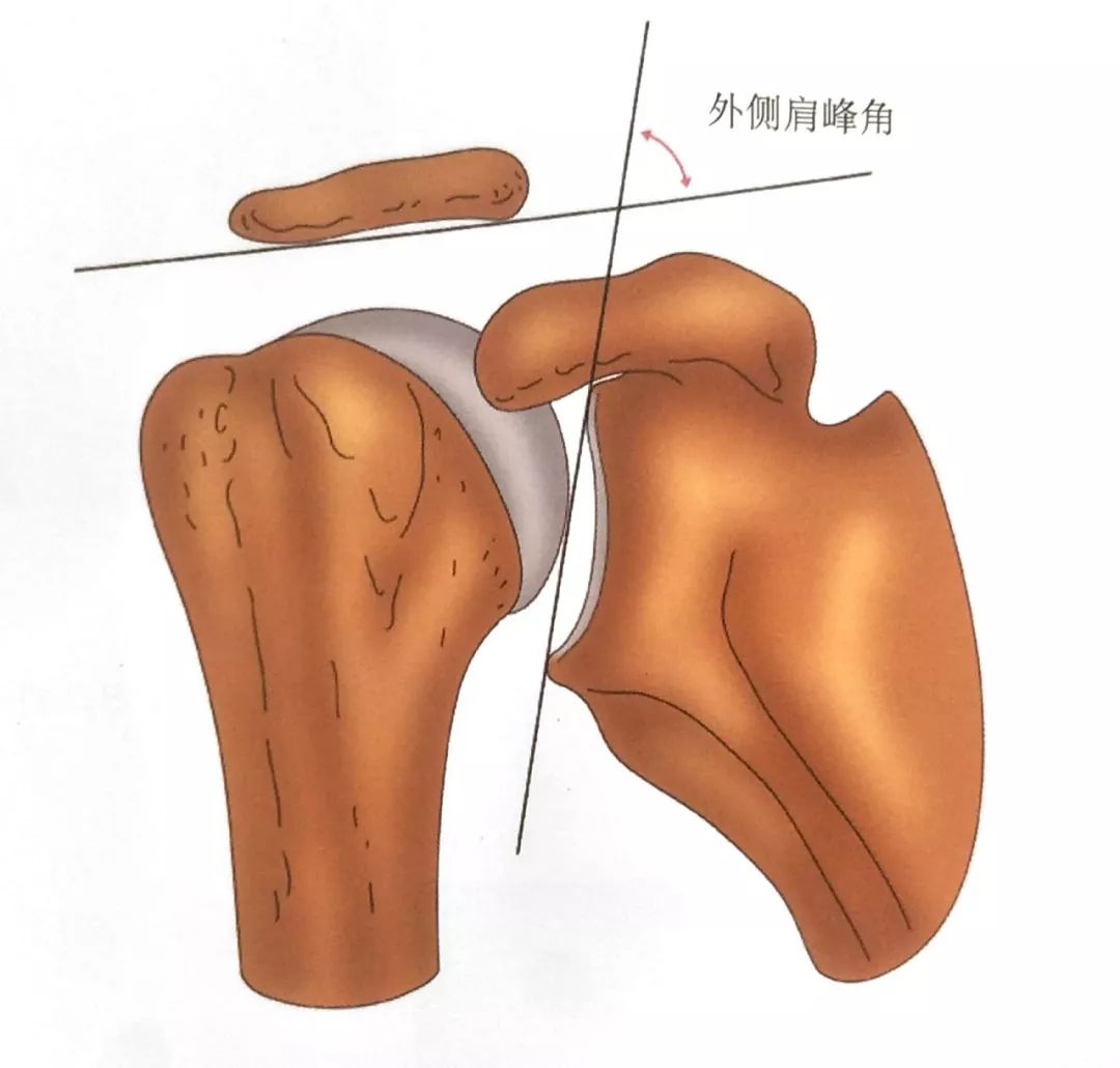 肩关节常见疾病这些诊疗常规你掌握了吗