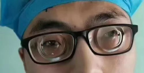 儿时近视不注意,这位超高近视患者视力只能提高到0.5_刘先生
