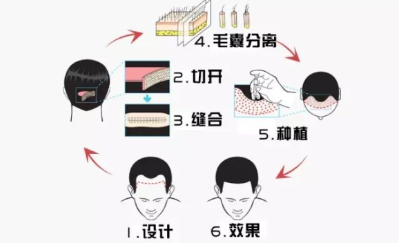 一般多久开始脱发 32dbb7a3221447c28c8256c2c5d7c182.png