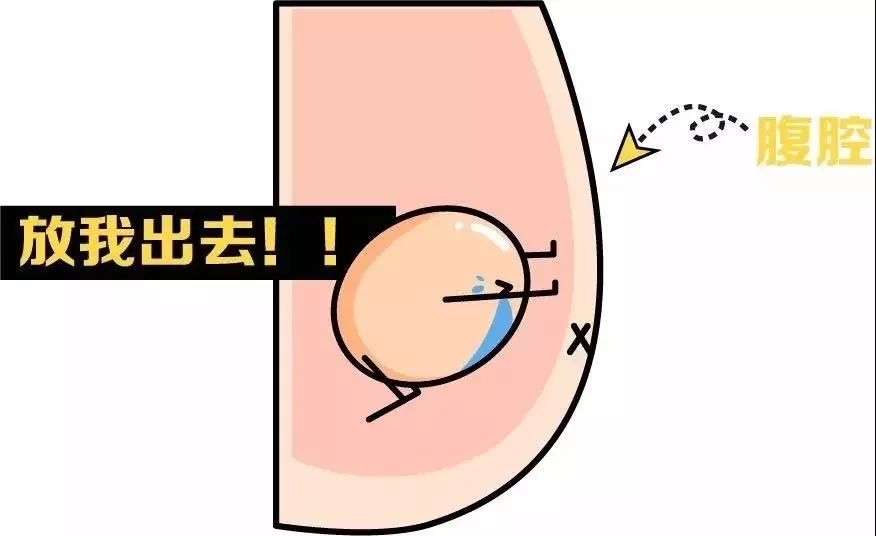 的某一部位包括停留在腹腔内的一种病理状态,临床上称为「睾丸下降不