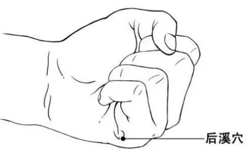 健康知识 | 注意!头痛是身体在示警!头顶痛、偏