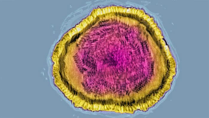 娃研所丨肺炎是5岁以下儿童死亡主因,治疗