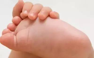                     关于宝宝的小脚丫，宝妈们一定不能忽视！