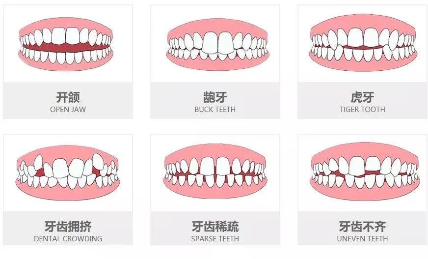 曝料: 西安这家网红口腔医院正在发放牙齿矫正补贴福利,看看你能领