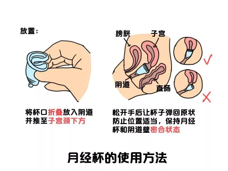 卫生巾,卫生棉条,月经杯优缺点大比拼,哪个才是你的最佳选择?