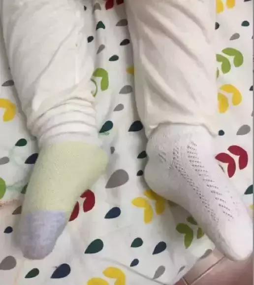 拔完火罐的正确做法是?看爸爸带娃,笑出猪叫…