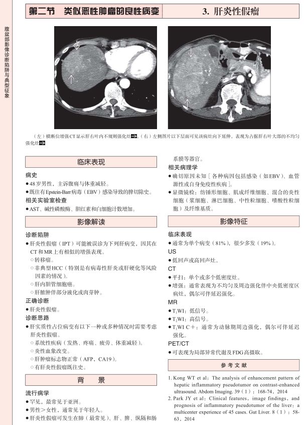 「新书上架」腹盆部影像诊断陷阱与典型征象