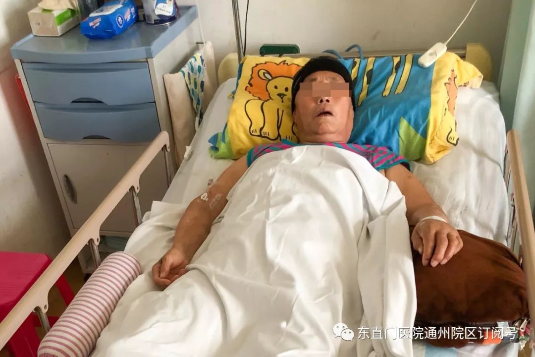 多科协作无缝衔接 绿色通道一路畅通——东直门医院通州院区救治急性脑出血患者一例! 必发888老虎登陆