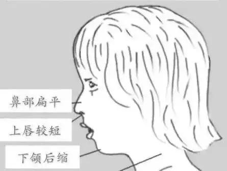                     宝宝这样做不会变丑哦