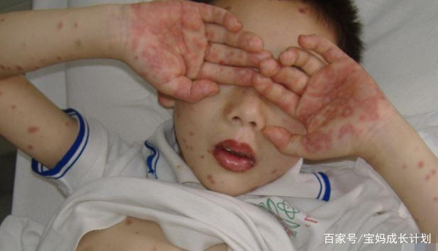                     男孩“偷亲”了小女孩一口，付出了很大的代价，家长别不当回事！