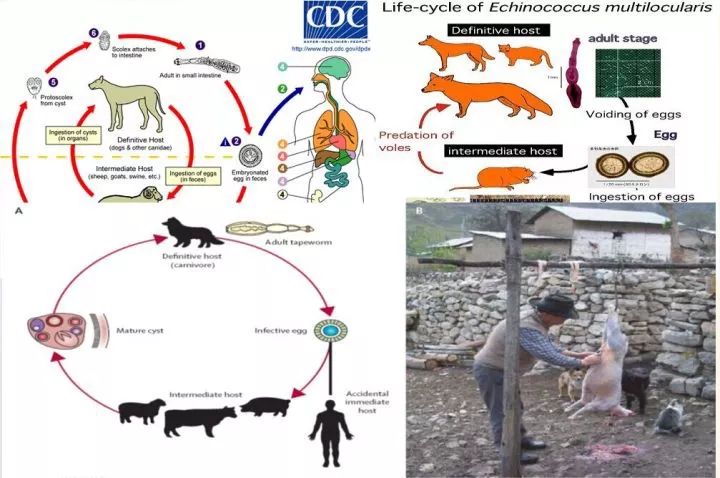 图解包虫病那些事!