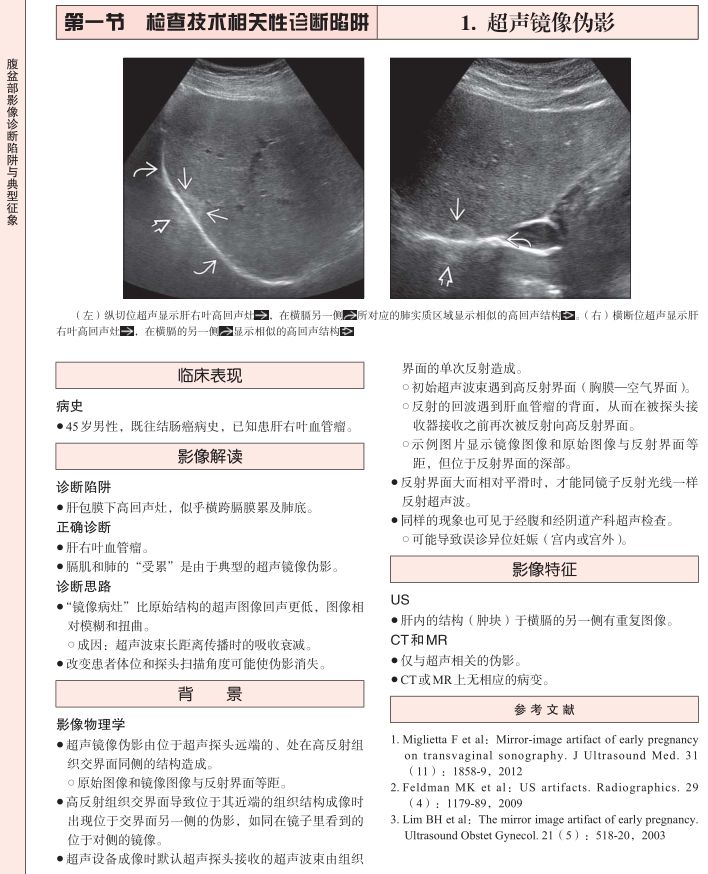 「新书上架」腹盆部影像诊断陷阱与典型征象