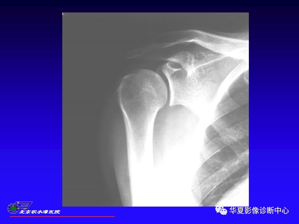 肩关节x线检查特殊体位