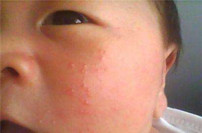                     家长要记住宝宝的身体缺锌6大点，说明孩子缺锌很严重！