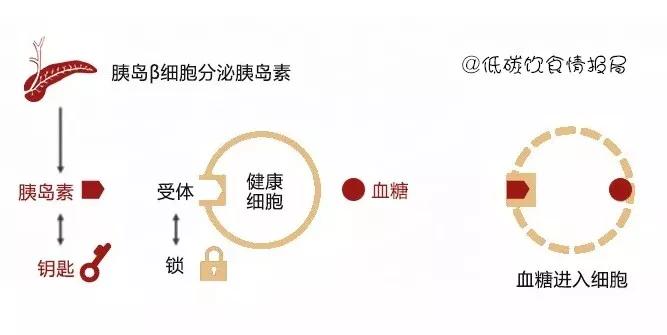 一文读懂2型糖尿病的病因真相！| 糖尿病专栏