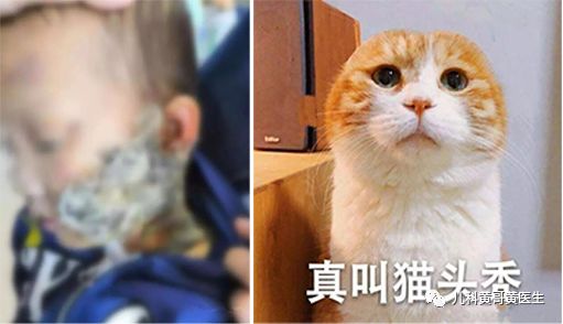                     警醒！孩子烫伤后因家长这个愚蠢的做法进了ICU！