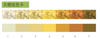 大便比色卡备注:1-3号大便颜色为异常,4号为临界颜色,5-6号为正常