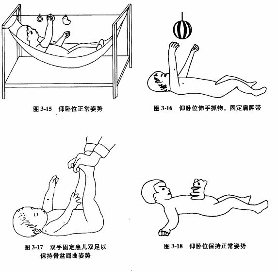 脑瘫儿童促进运动发育的作业治疗保持正常姿势