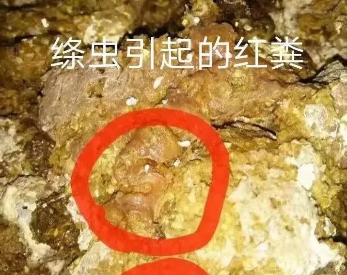 为什么大便拉出来是红色的 10926c441b1c4e868ef81bbd849fb2dd.jpeg