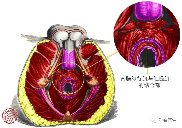 需要注意的是:在肛提肌与肛门外括约肌之间,存在着直肠纵行肌和肛提肌