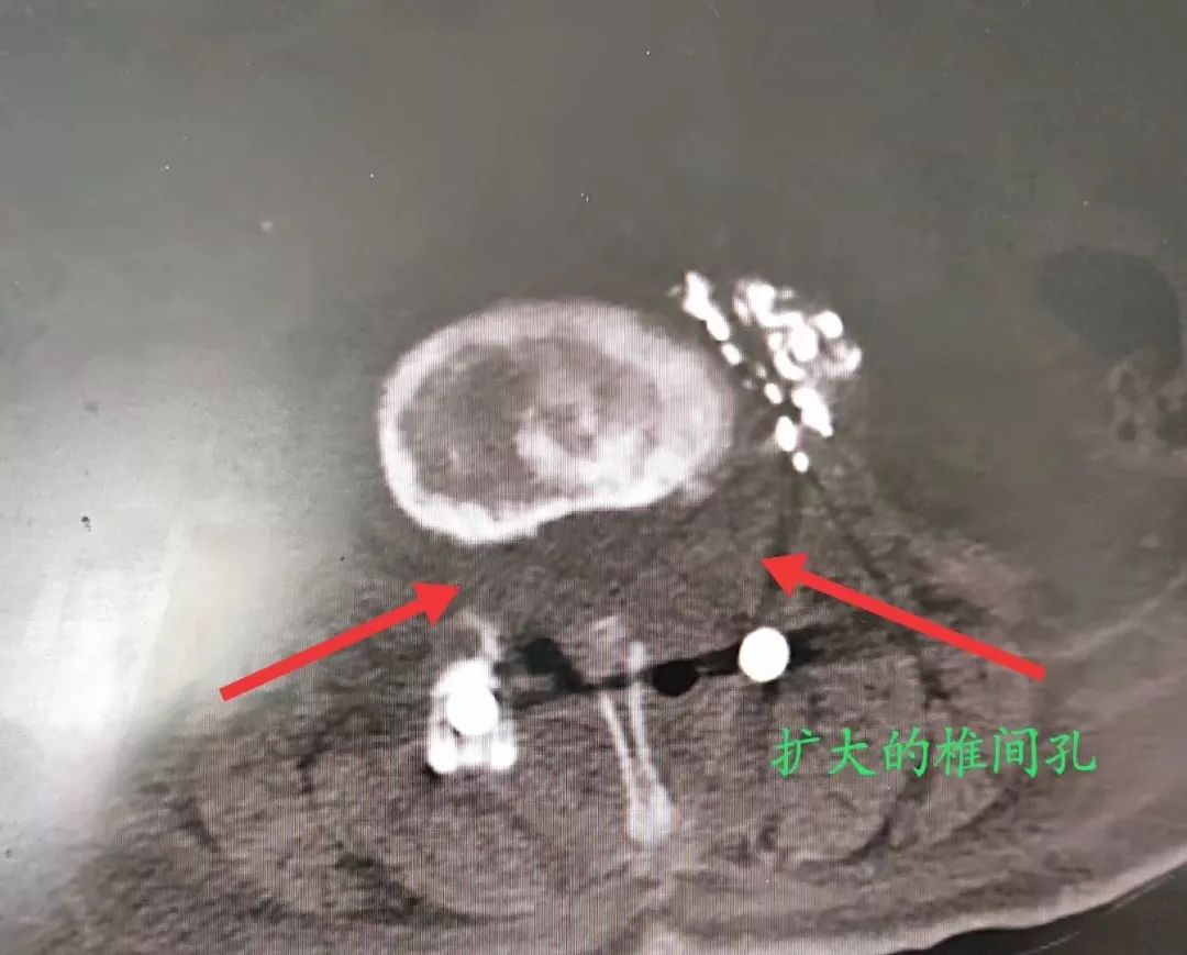 滚蛋吧肿瘤君致敬抗癌英雄