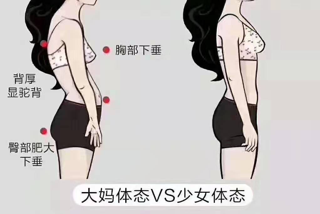 臀部肥大下垂,胸部下垂,驼背