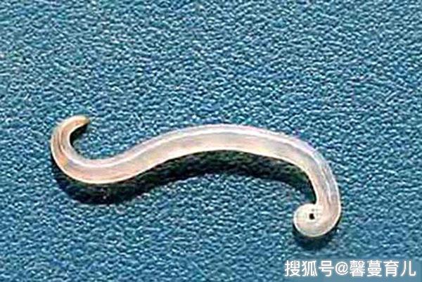                     原创            5岁女儿总说屁屁痒，老是用手挠，脱衣检查后，宝妈腿都吓软了