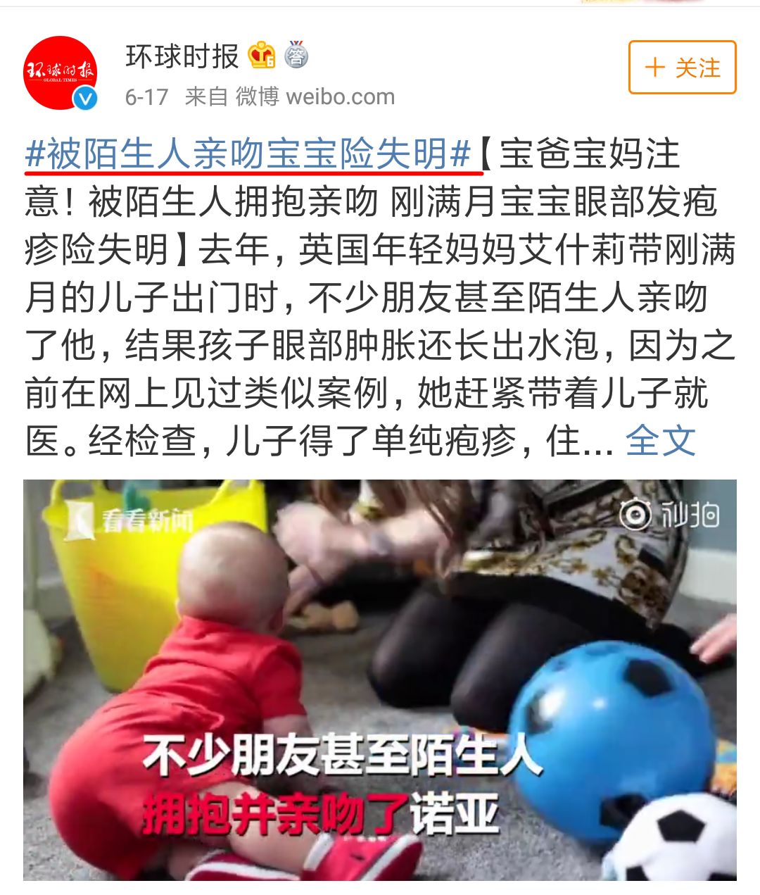                     因一个亲吻，孩子险失明！别再乱亲孩子了！
