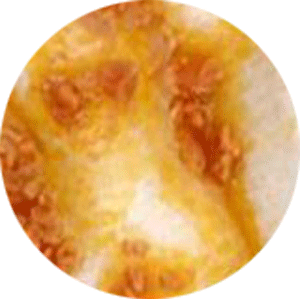                     究竟宝宝一天大便几次才算是正常的？这些情况要就医！