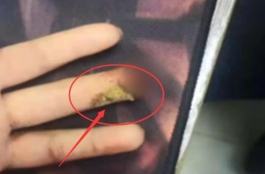                     2岁男童凌晨发烧身亡，只因爸爸一个动作！医生痛心：这种错误很多家长还在犯！