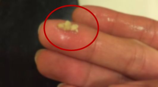                    校园霸凌？6岁男孩遭遇同学嘲笑欺压，原因让网友傻眼？